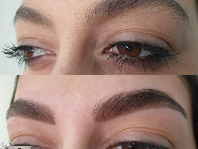 Bragina brow